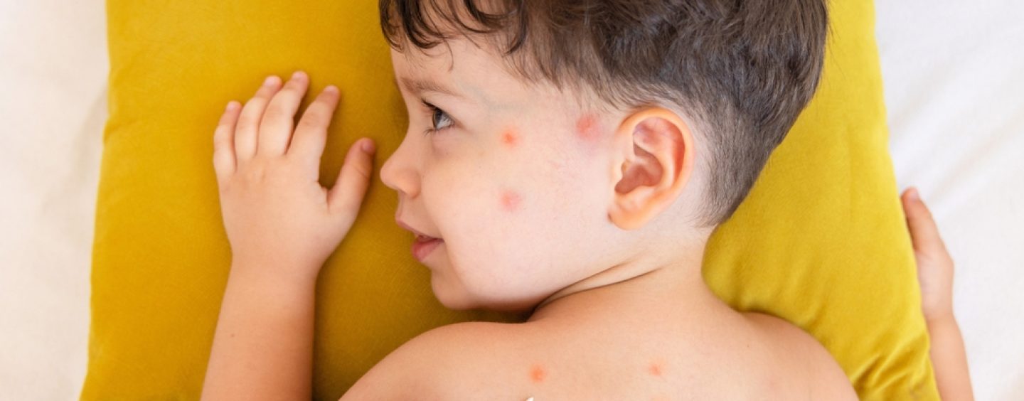Geluri calmante pentru înțepăturile de insecte: ghid practic cu soluții eficiente și naturale
