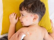 Geluri calmante pentru înțepăturile de insecte: ghid practic cu soluții eficiente și naturale